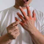 5 signs of increased uric acid seen in body– 3 simple steps to fix it