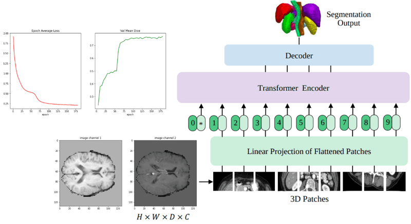 medical-segmentation-transformers.png